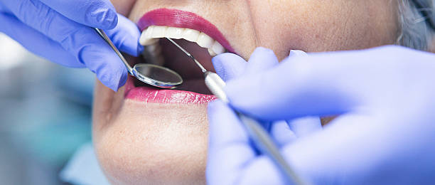 Best Emergency Dentist for Knocked-Out Tooth in Dyersville, IA