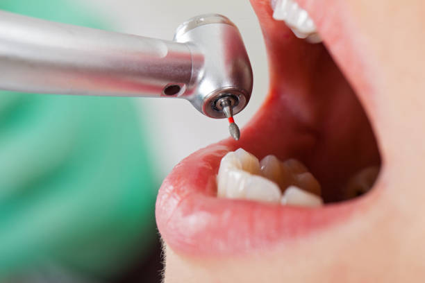 Best Broken or Cracked Tooth Emergency Dentist in Dyersville, IA